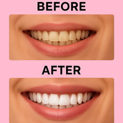 Glow Smile Bundle | Aardbei Whitening strips, aardbei charcoal poeder en de lip mask